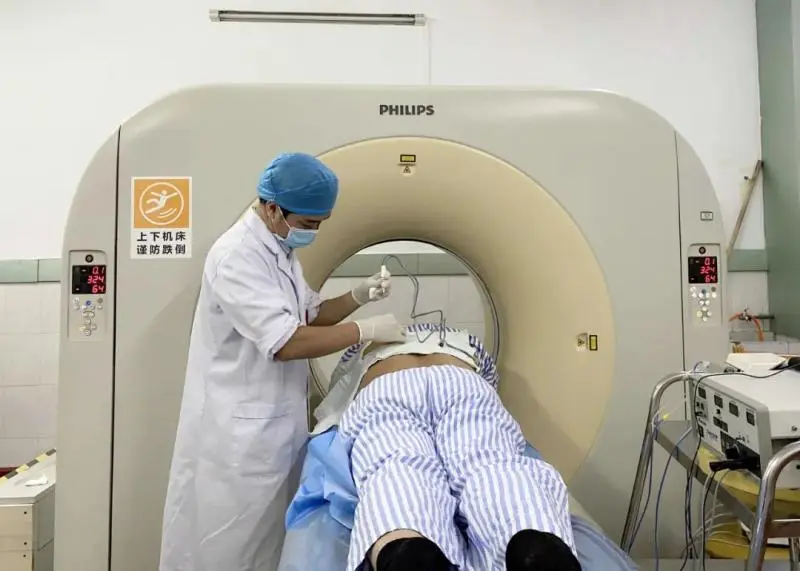 【中心医院·医者红】“热死”癌细胞，这个技术牛！