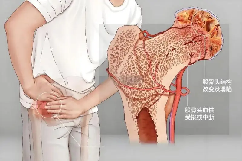 【中心医院·医者红】这一“惠景经验”有望写入中国专家共识 【中心医院·医者红】这一“惠景经验”有望写入中国专家共识