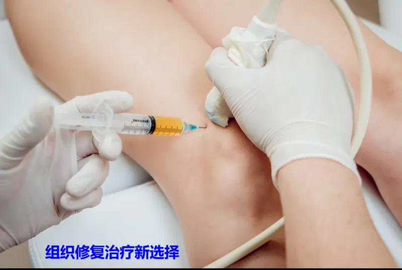 【中心医院·医者红】这一“惠景经验”有望写入中国专家共识 【中心医院·医者红】这一“惠景经验”有望写入中国专家共识