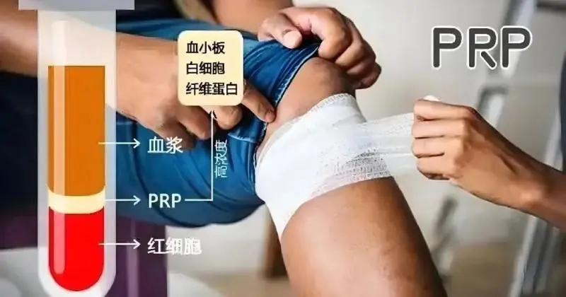 【中心医院·医者红】这一“惠景经验”有望写入中国专家共识 【中心医院·医者红】这一“惠景经验”有望写入中国专家共识