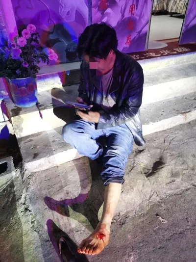 男子骑车脚被撞受伤 特警及时开展救助