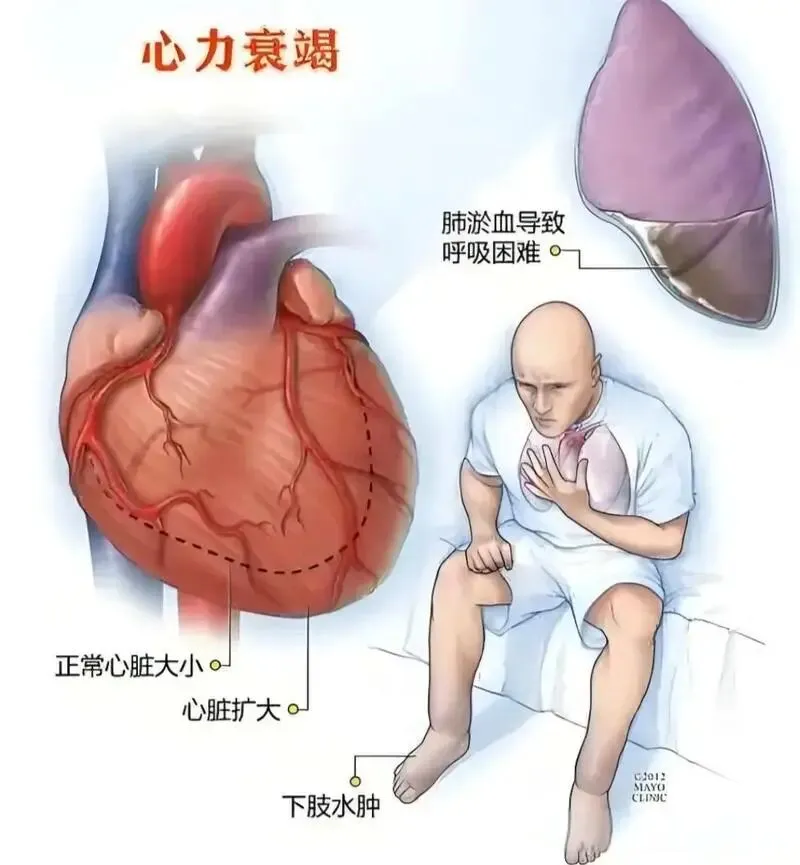 84岁重症救治成功！湘潭市中医医院中西医结合诊疗显功力