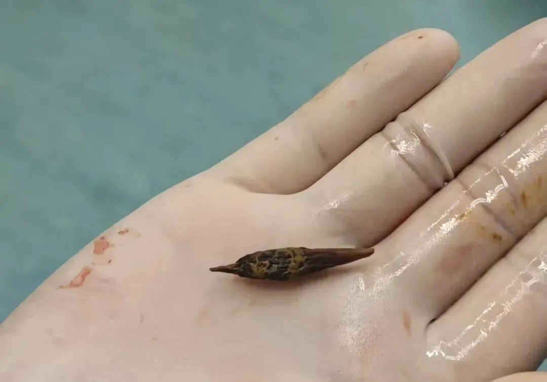 给家里老人提个醒:吃枣千万别大意
