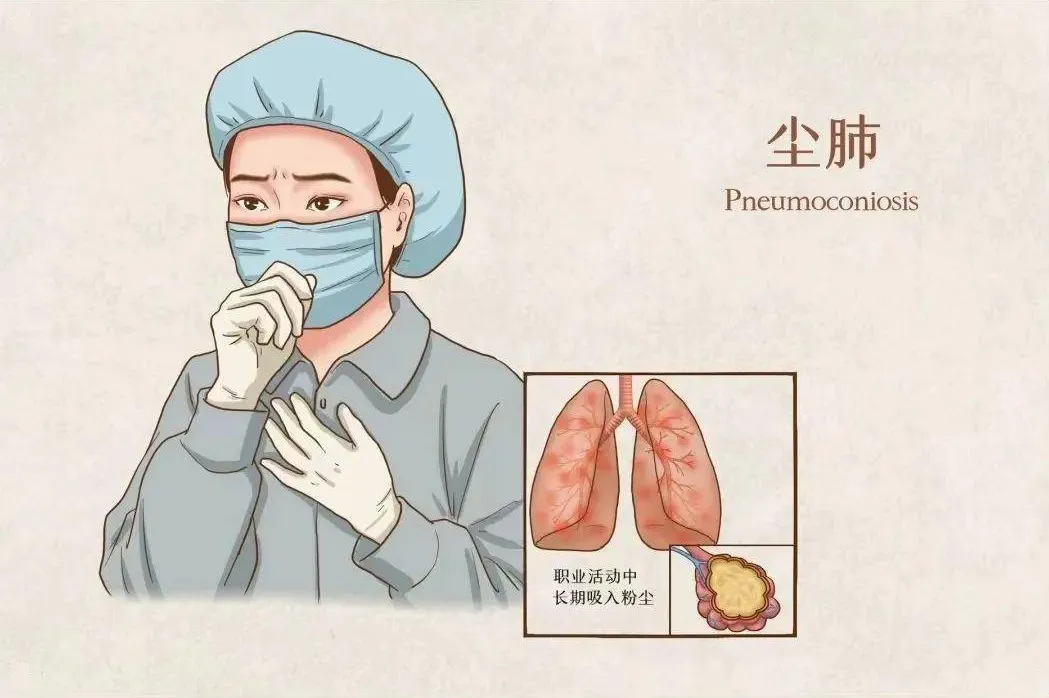 诊断书丢了,希望没丢——呼吸与危重症医学科助农民工尘肺患者重获救治