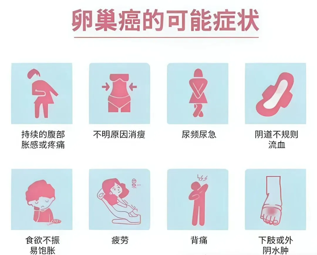 警惕妇科“沉默杀手”-卵巢癌!