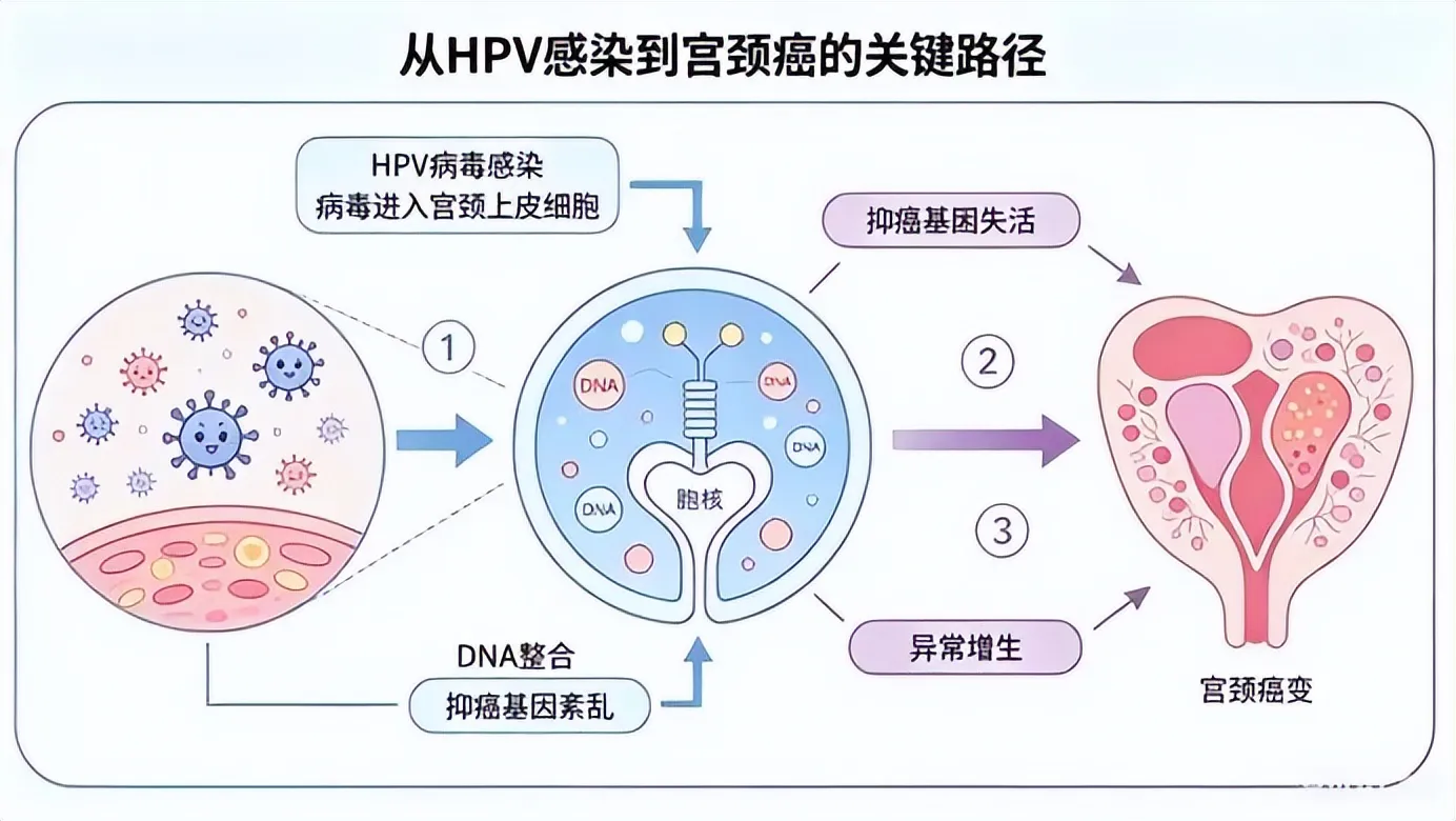重要提醒!进口九价HPV疫苗惠民接种活动即将结束
